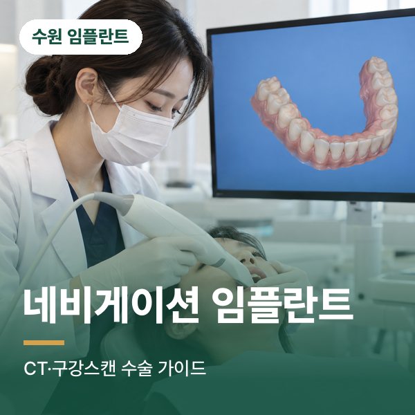 네비게이션 임플란트